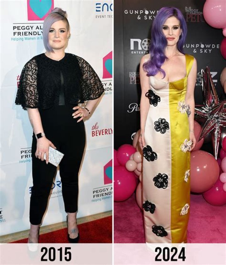 
Kelly Osbourne’s Impressive Weight Loss Over The Years, Fans Wonder About Her Health Condition Amid Pregnancy Announcement 